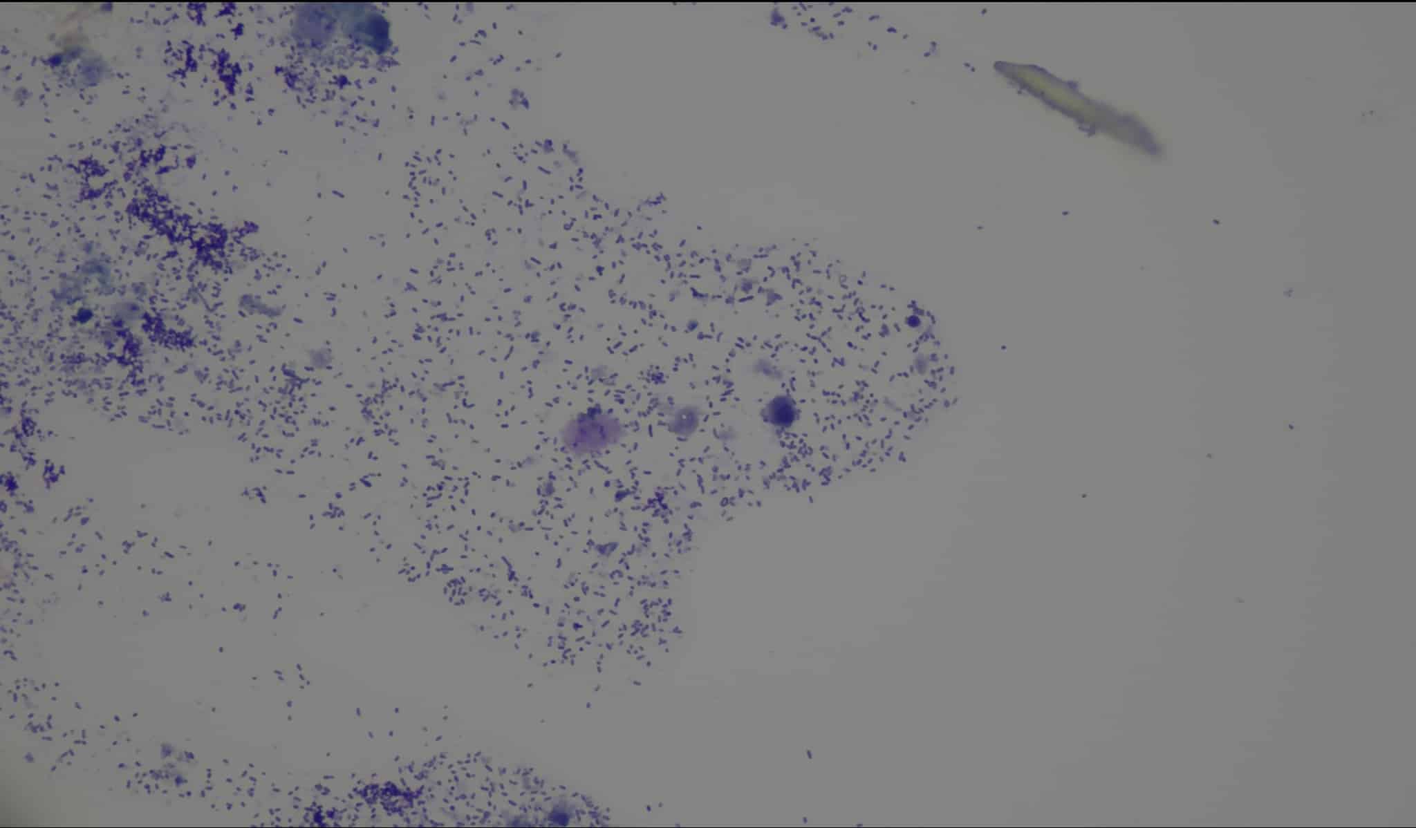 Abundant Pseudomonas bacteria at 400x magnification