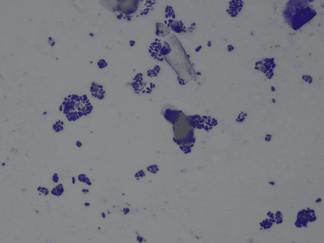 Malassezia Hefepilze in 400 facher Vergrösserung