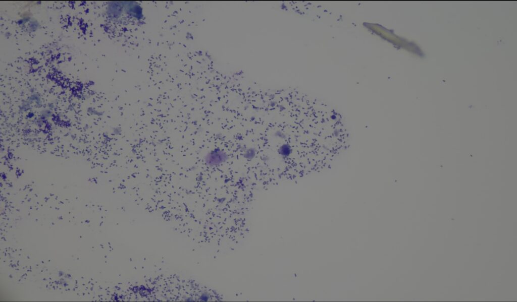 Massenhaft nachgewiesene Pseudomonas Bakterien in 400 facher Vergrösserung
